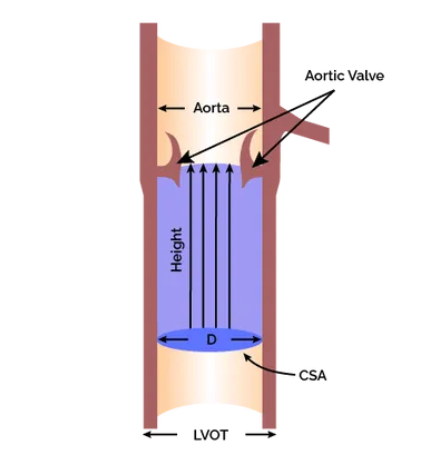 Doppler Echo Cardiac Output Calculator Diagram