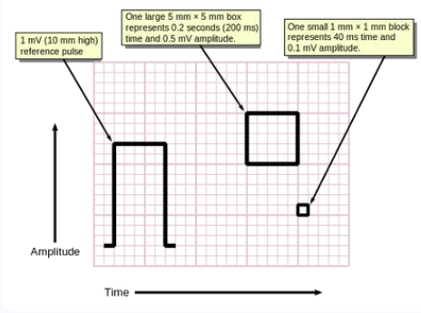 ECG Boxes to Seconds Calculator Diagram