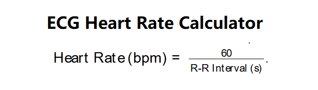 ECG Heart Rate Calculator Diagram